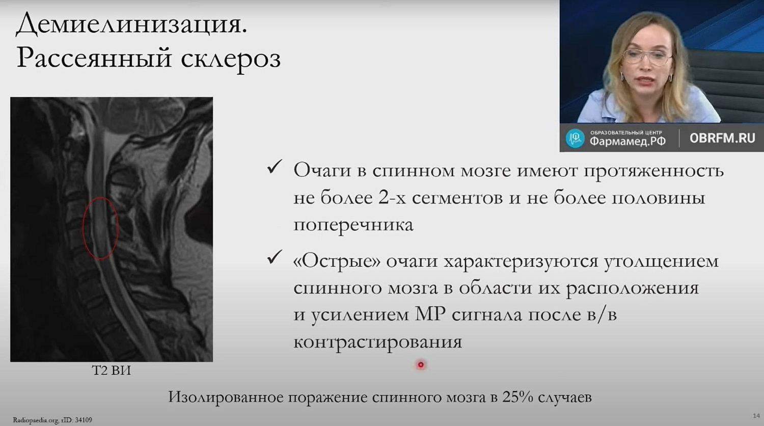 Лекция «Лучевая диагностика миелопатий»