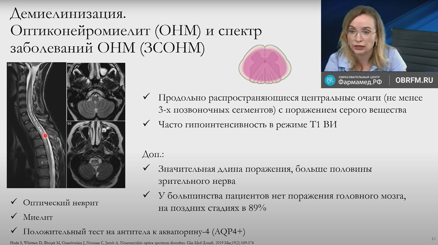Лекция «Лучевая диагностика миелопатий»